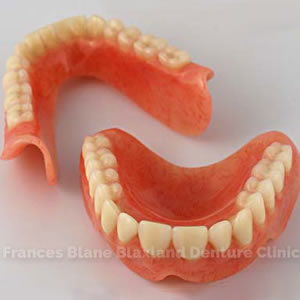 immediate false teeth